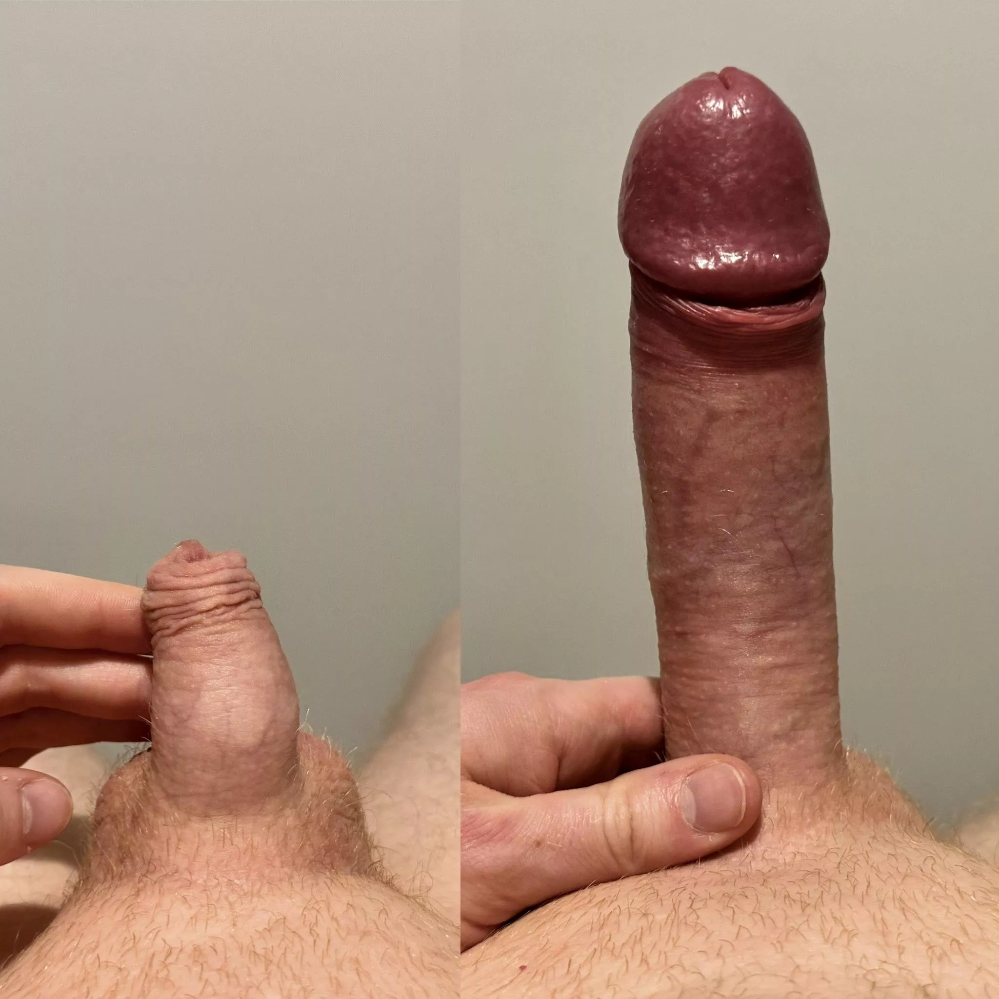 Soft vs Hard posted by Confident-Ad11011