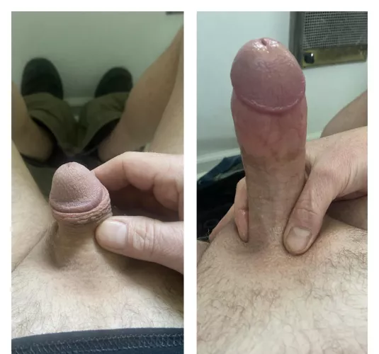 He grows by Limp_Back_5839