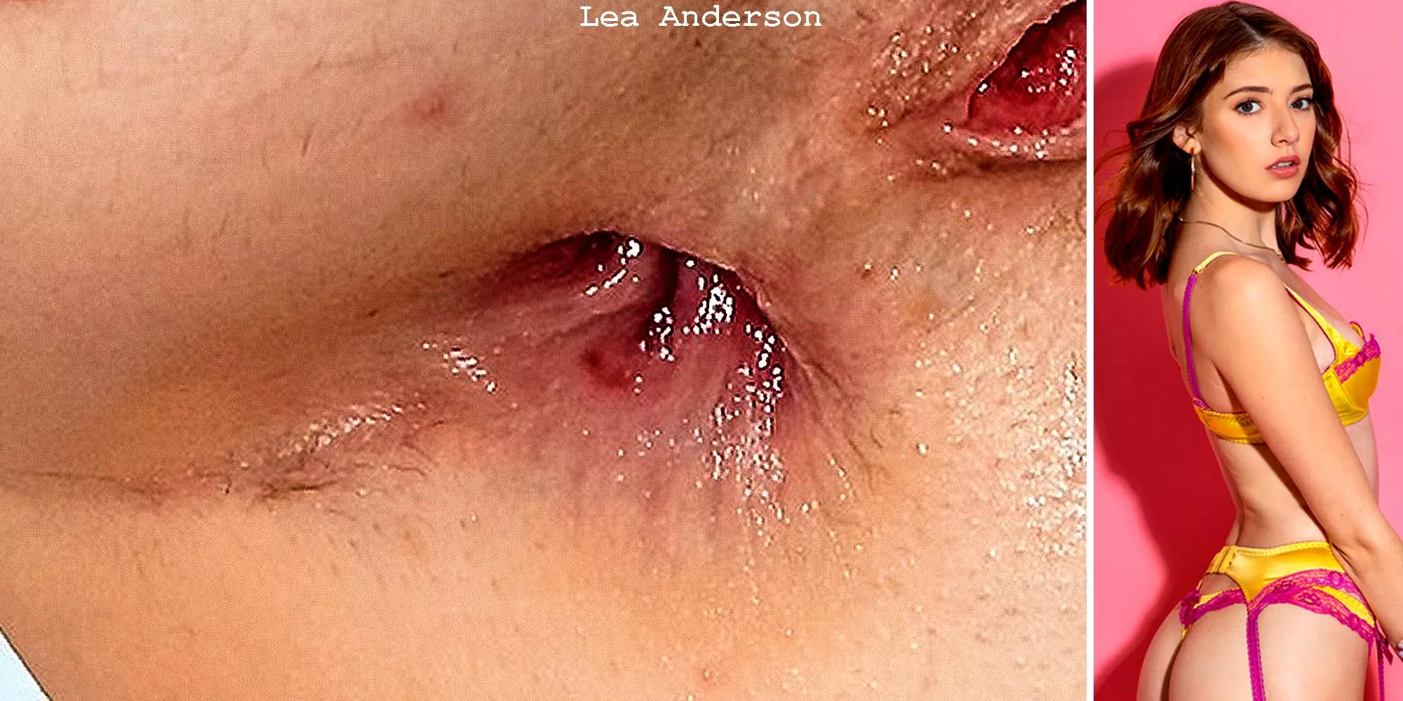 Lea Anderson - still burning posted by PaulLegendar