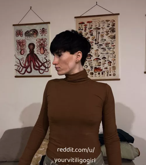 Night out  by yourvitiligogirl