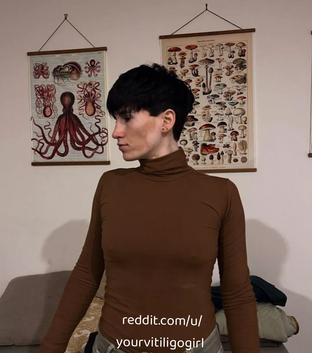 Night out  posted by yourvitiligogirl