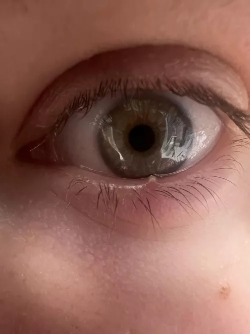 Painful stye lower eyelid by New-Huckleberry-7129