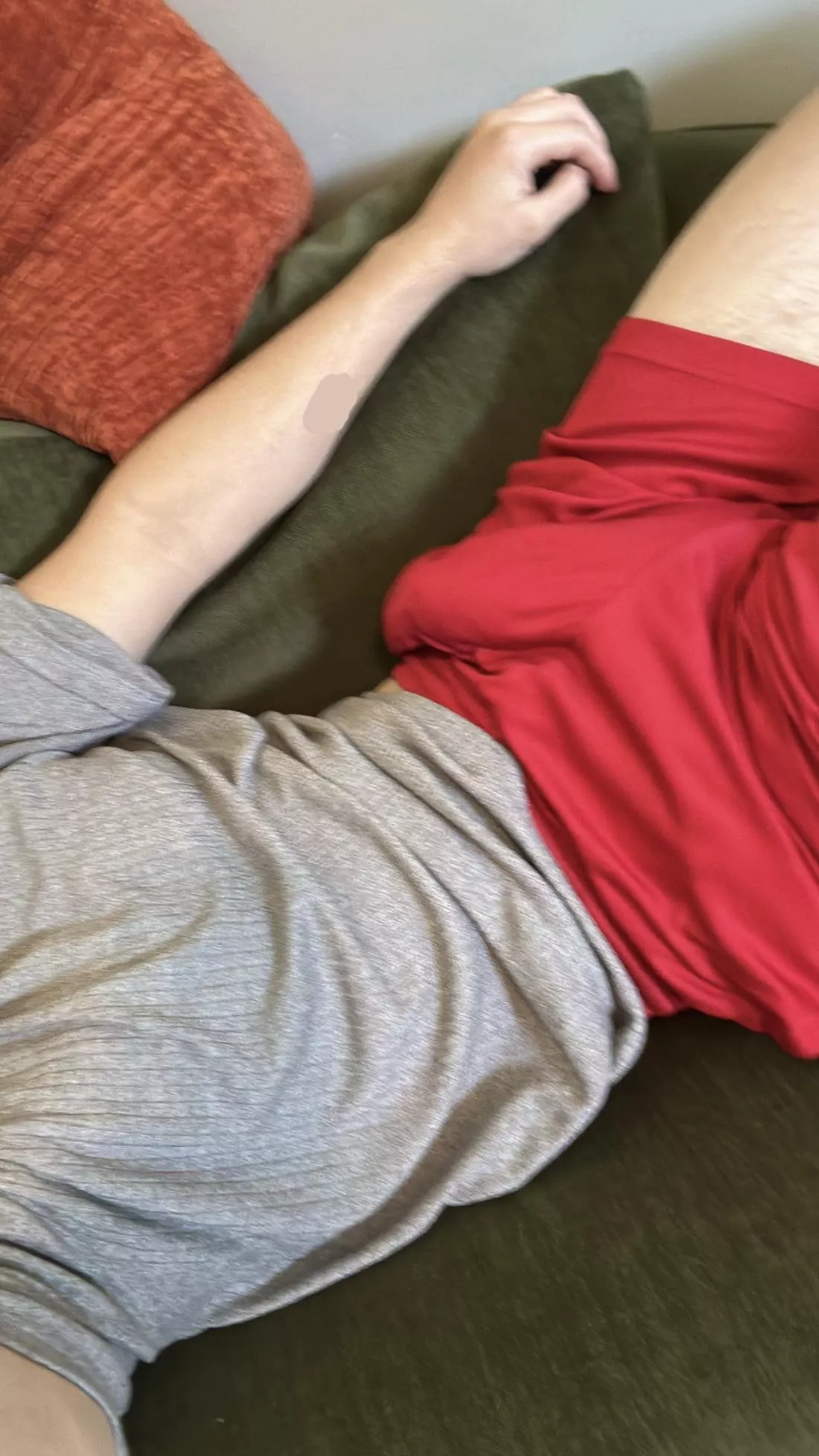 Soft bulge  posted by PollutionSoggy4762