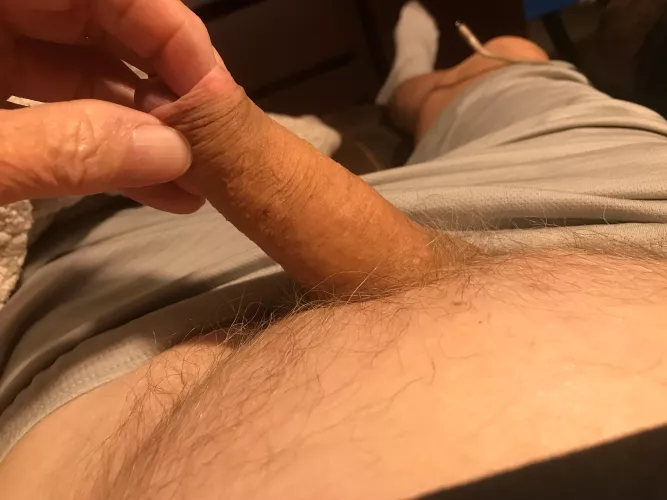 What do you think about my foreskin by Working_Key_1128