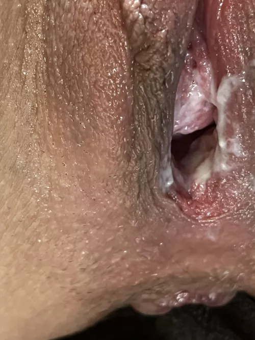 I gaped my pussy and busted my ass. Here’s the aftermath of my fisting session ❤️ by nymphme