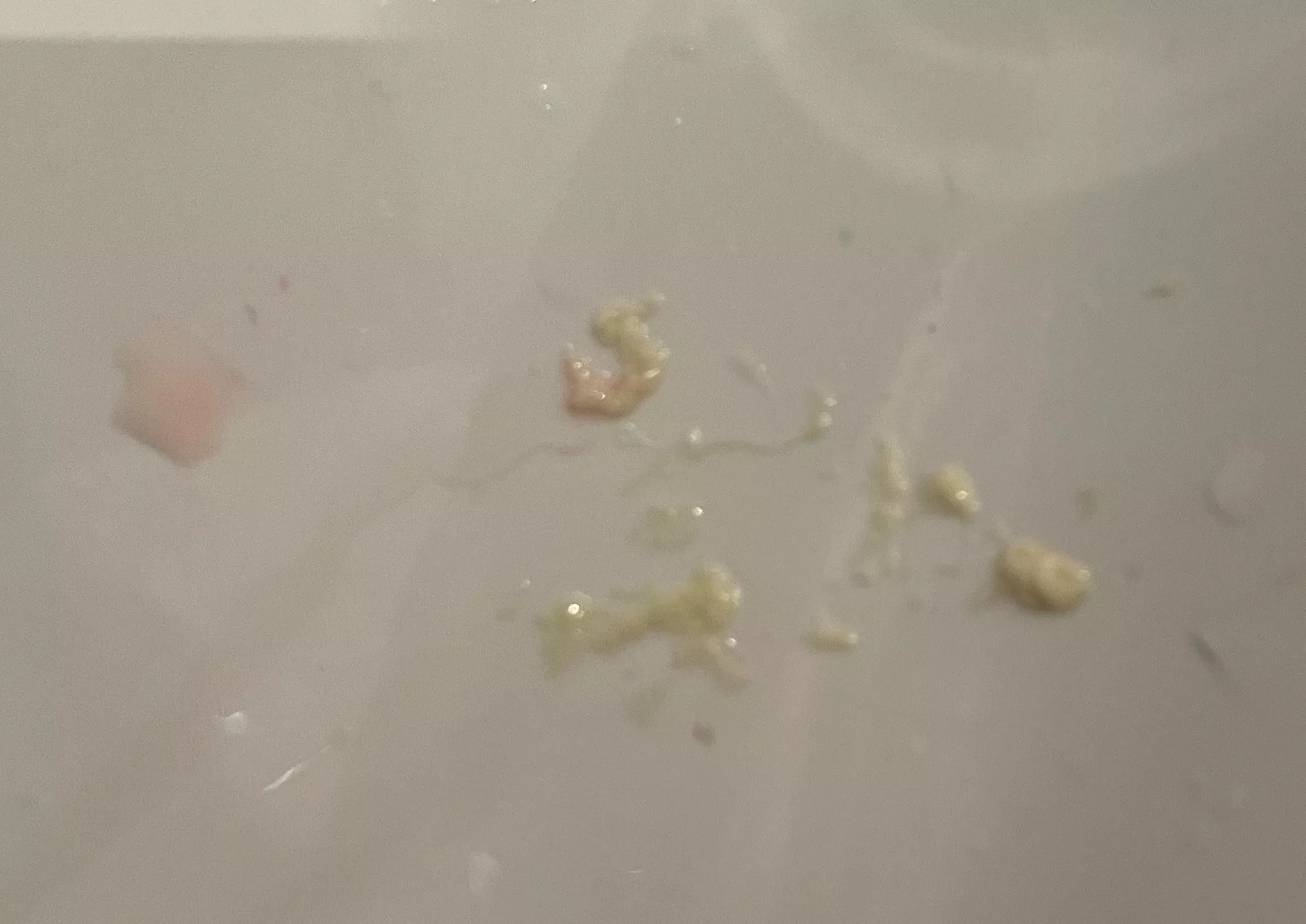 Popped a milk bleb on my nipple and unclogged a milk duct that had given me mastitis (being treated). Felt so much better after the thick milk came out! posted by Peek44