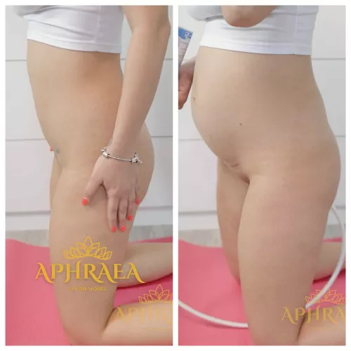 Whipped Cream Inflation by Aphraea-of