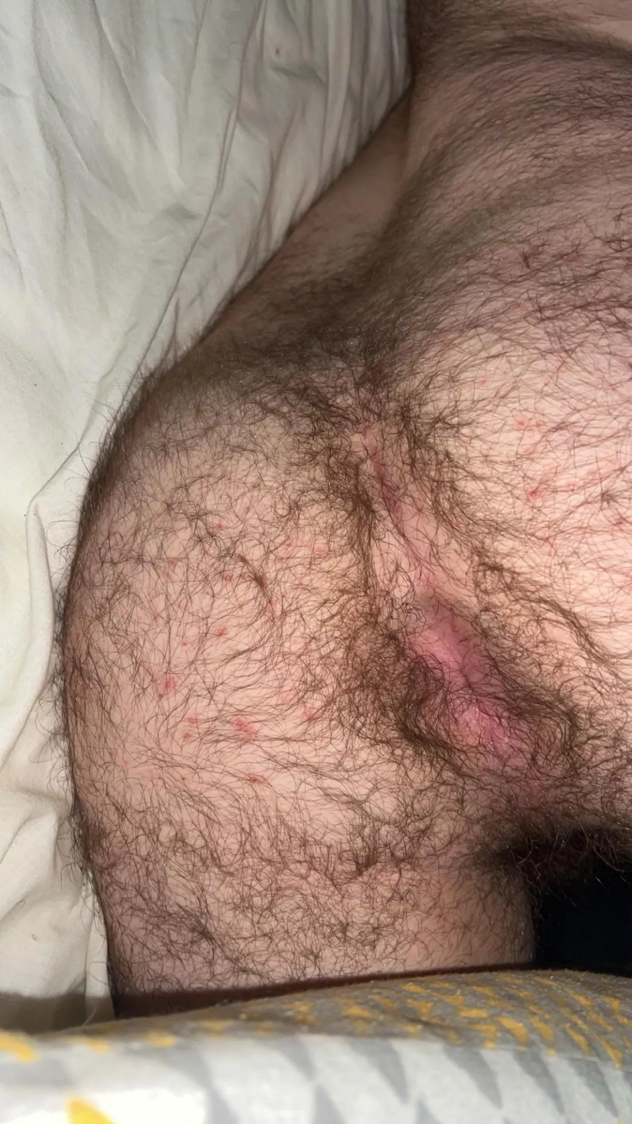 20, who wants a grab? posted by AgileNotice2036