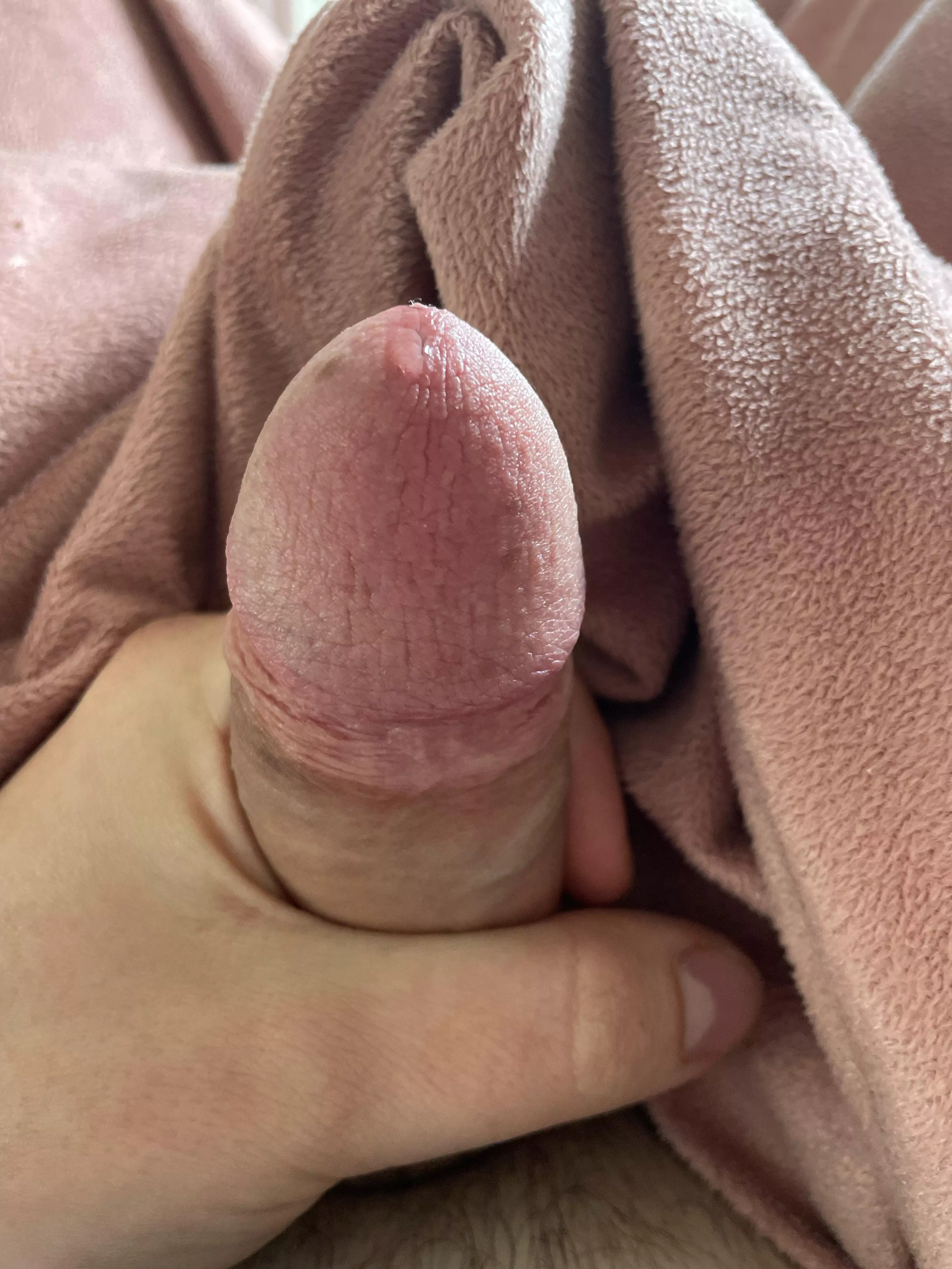 Edging posted by essen_1907