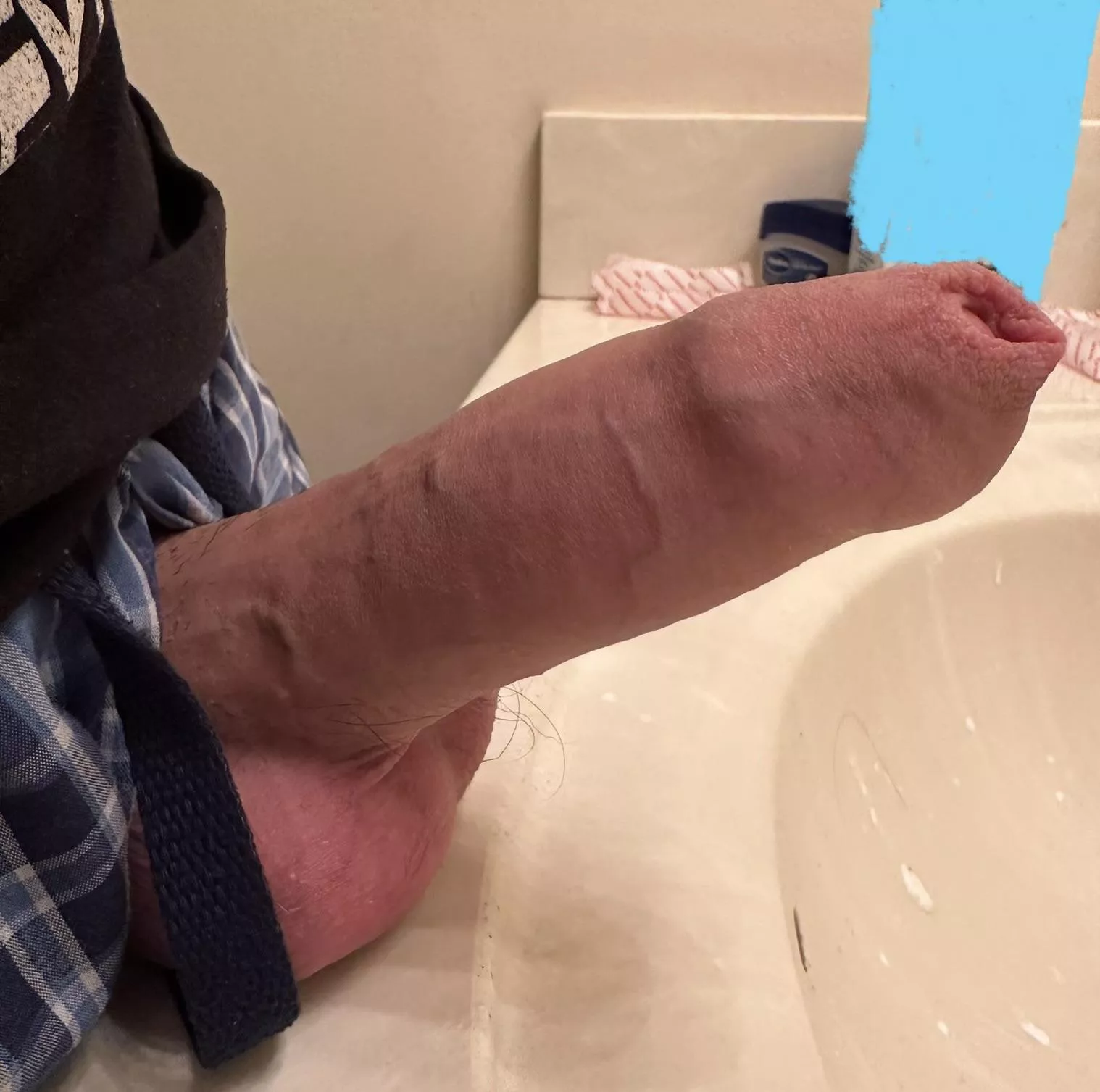 Is it just me or is the foreskin is the BEST part of the penis? posted by Main_Platypus71