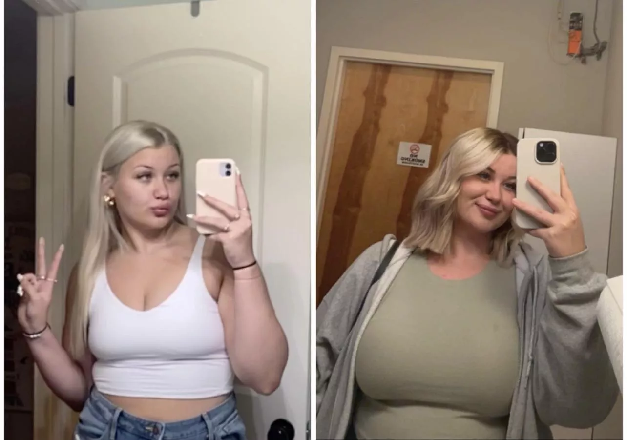 What gaining 100 pounds does to you posted by ratfat47