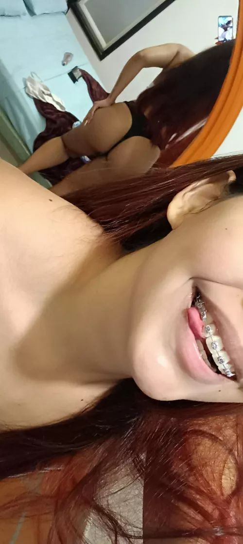 Braces and butt what's your favorite? by rossweetie_