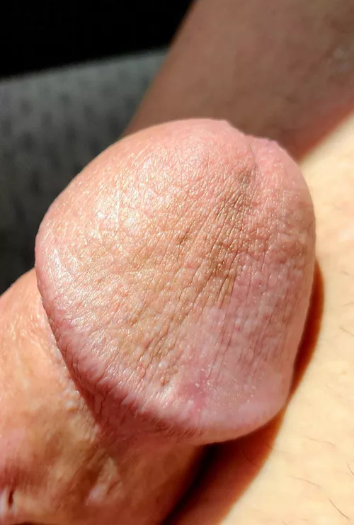 Well shaped head  by Independent_Prize453