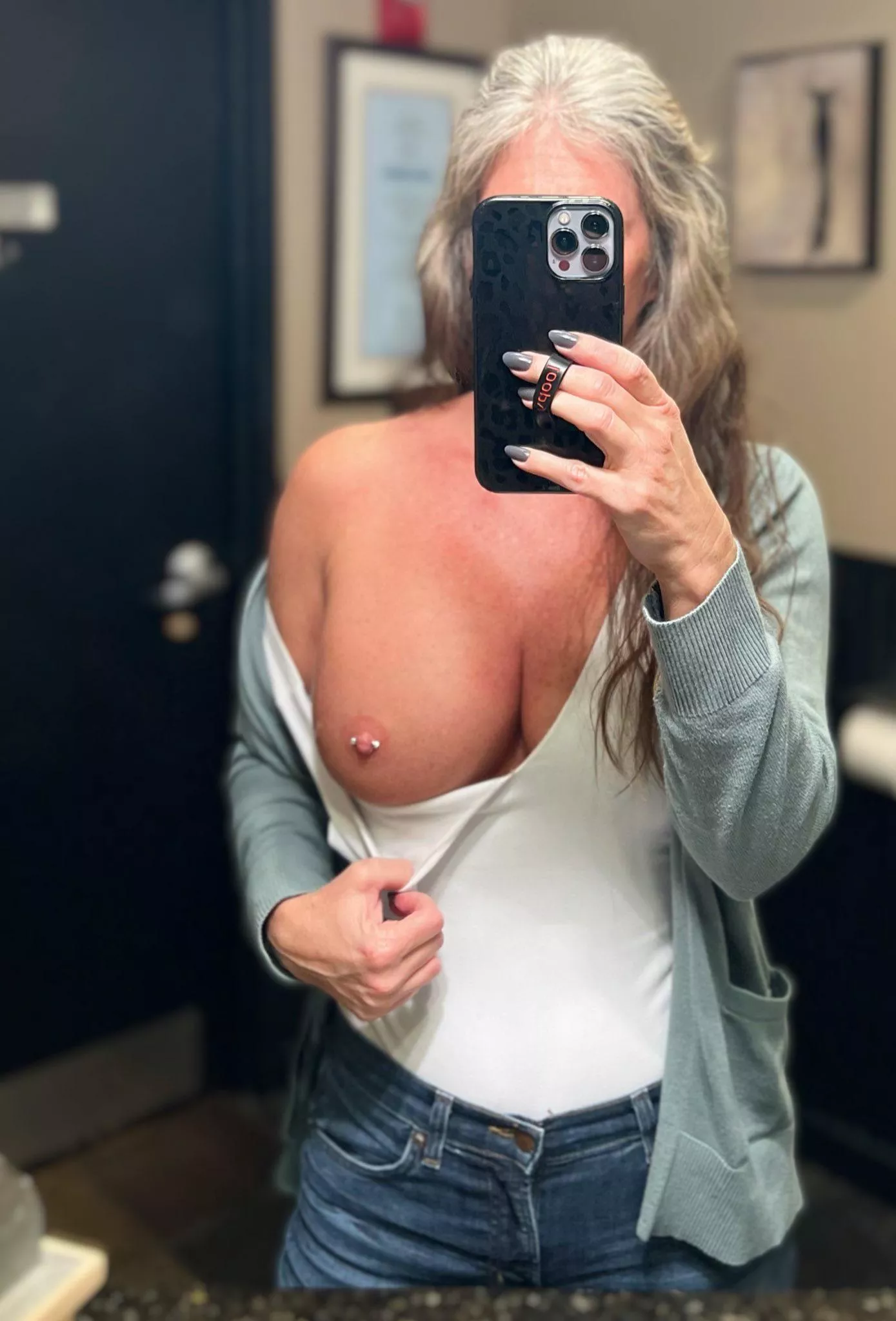 Full boob burn posted by Icy-Dragonfruit8787
