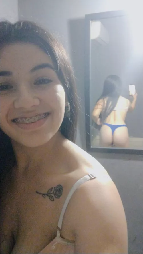 selfie of my face with braces and a lot of saliva by barbyantonela