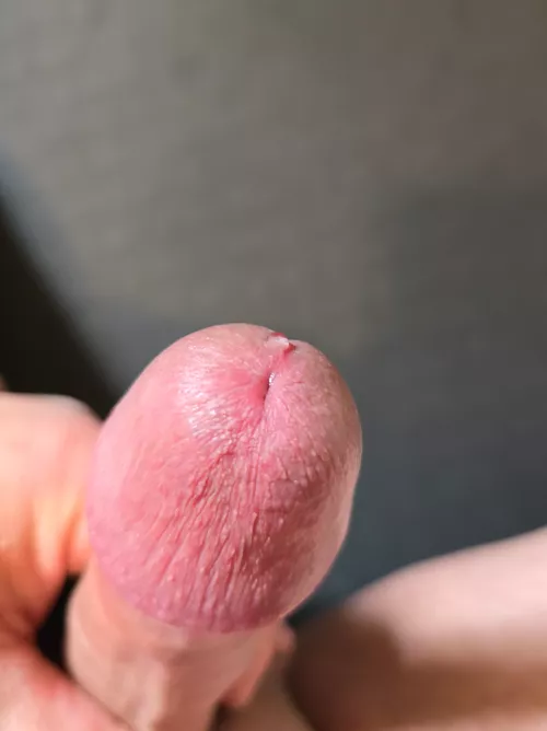 Start of a drip.... by Jimtom1989