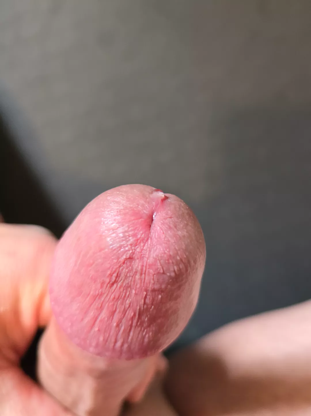 Start of a drip.... posted by Jimtom1989