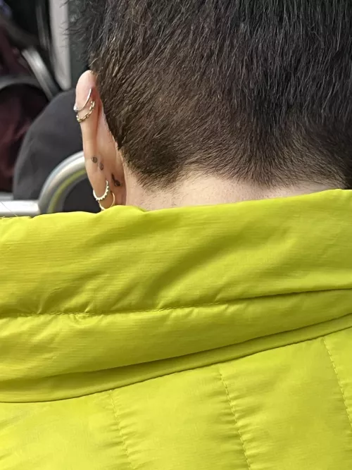 Thought these were blackheads at first, super disappointed by LJayEsq