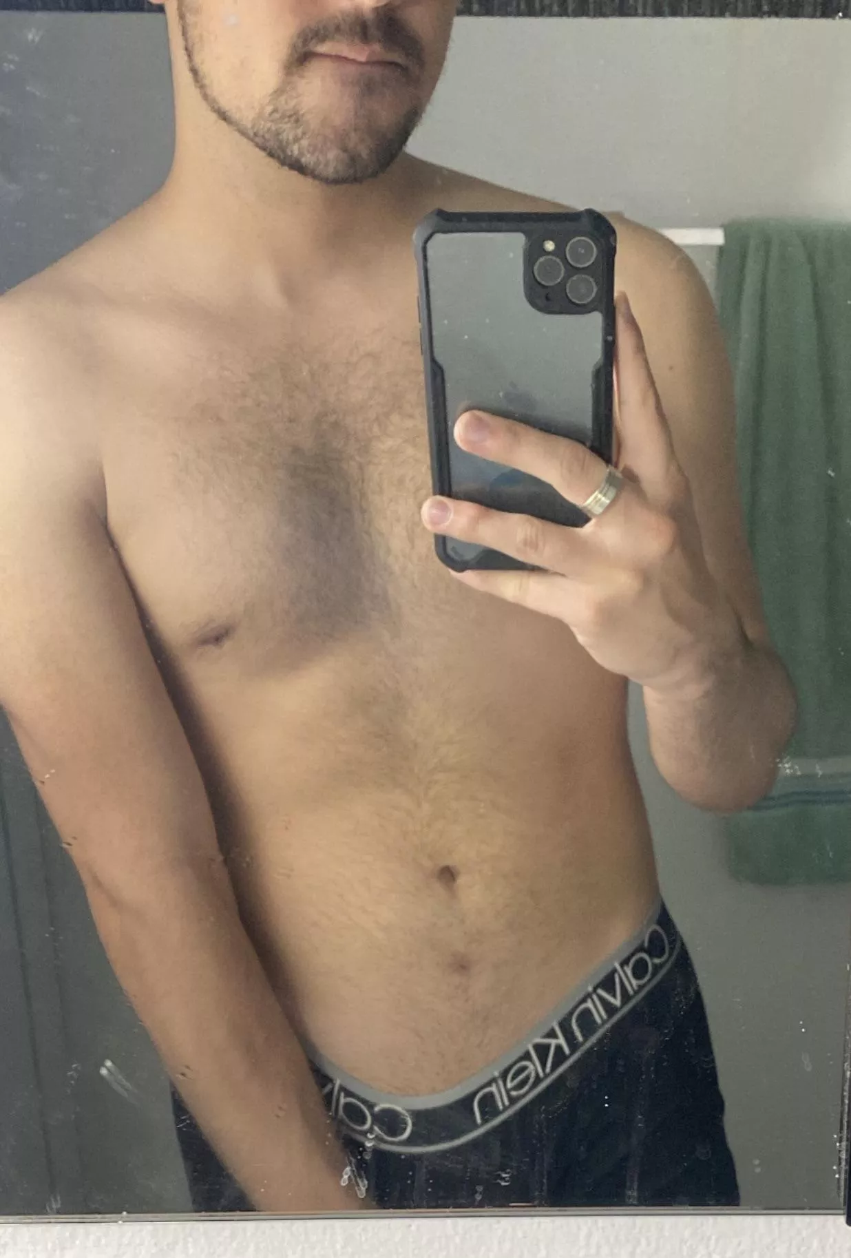 Finally can take them off 😜 posted by Prudent_Fun_1760