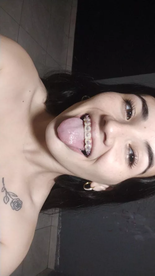 how do they look? promo they will remove my braces by barbyantonela