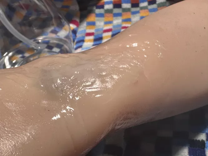 Repair Question: Skin Smoothing by Unusual-Option-6662