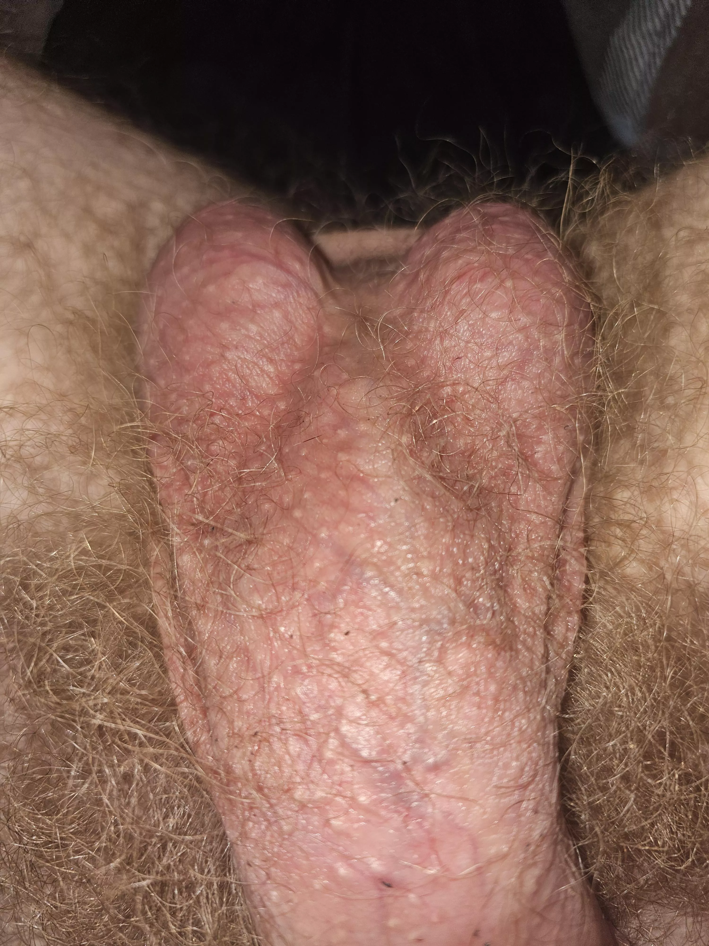 Smell my hairy crotch/balls? posted by KinkTwinkOtter