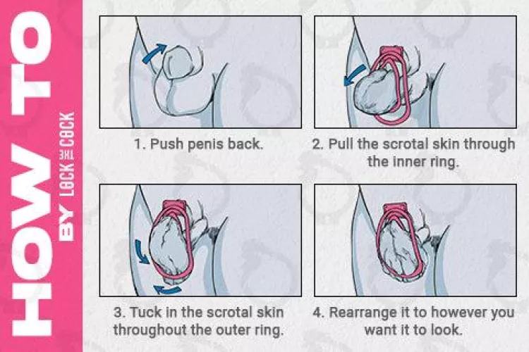 Fufu clip installation by LankyTurtle14