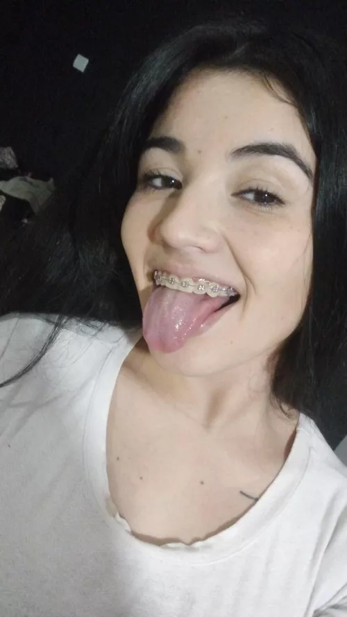 What do you think of my pink braces? by barbyantonela