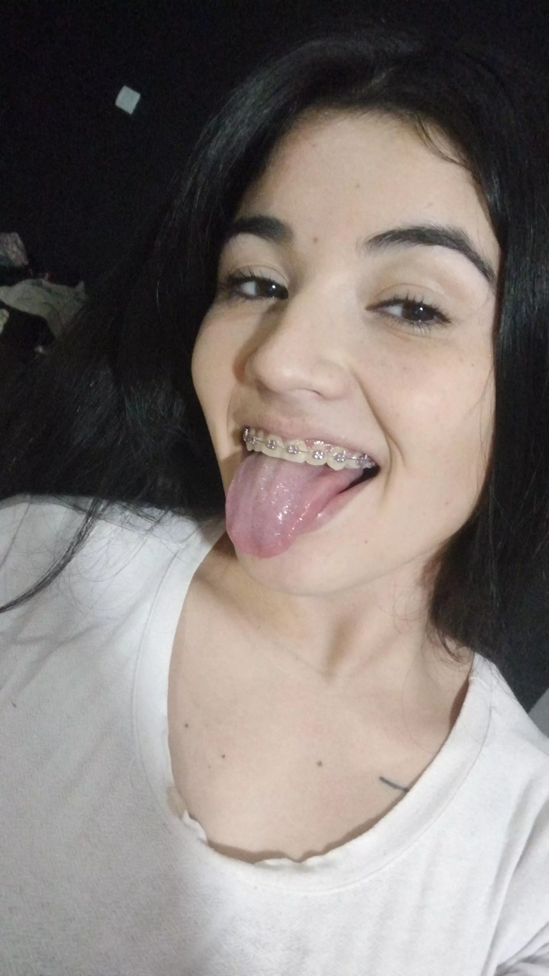 What do you think of my pink braces? posted by barbyantonela