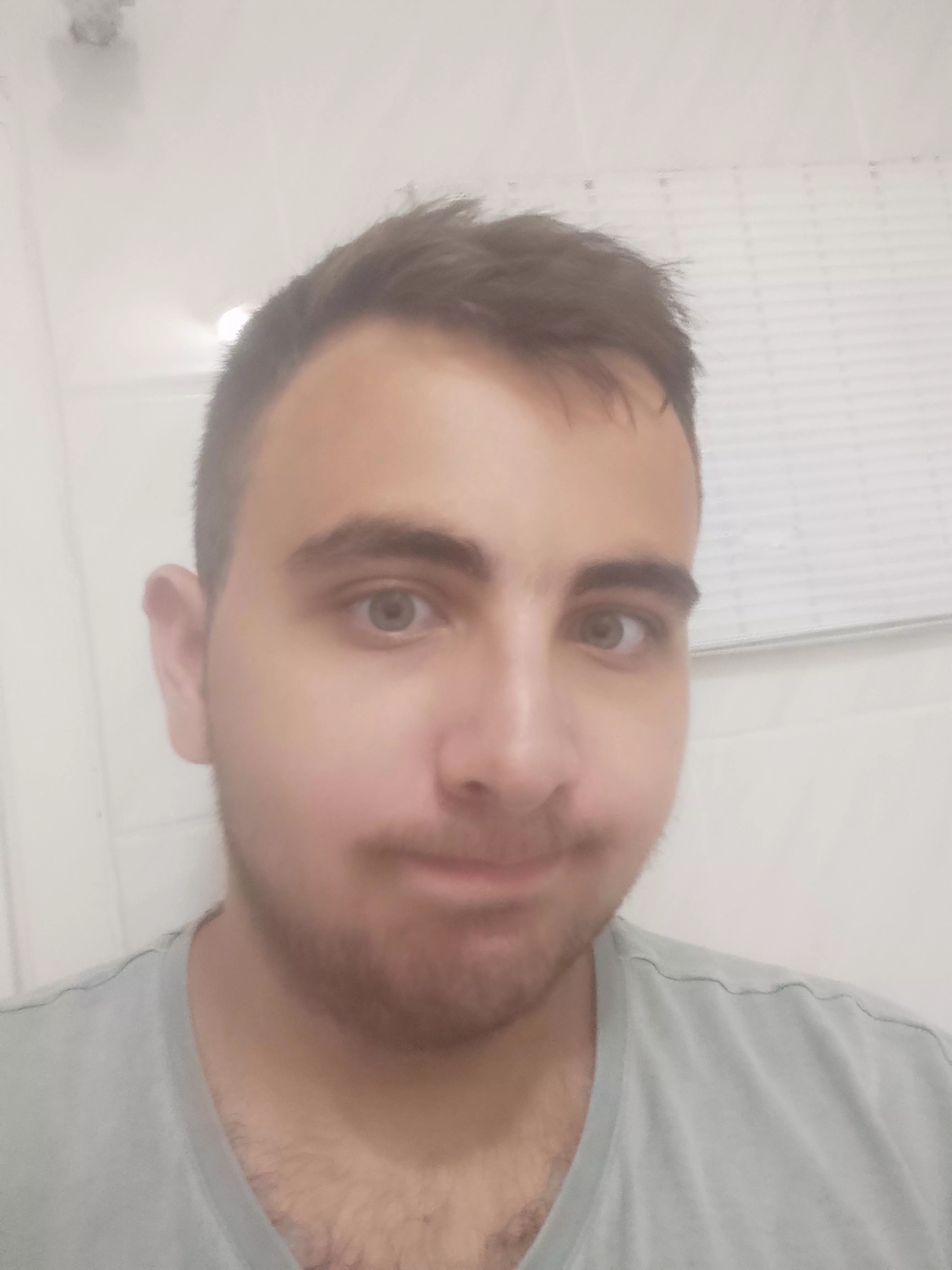 Am i ugly? posted by SuperSoldier31