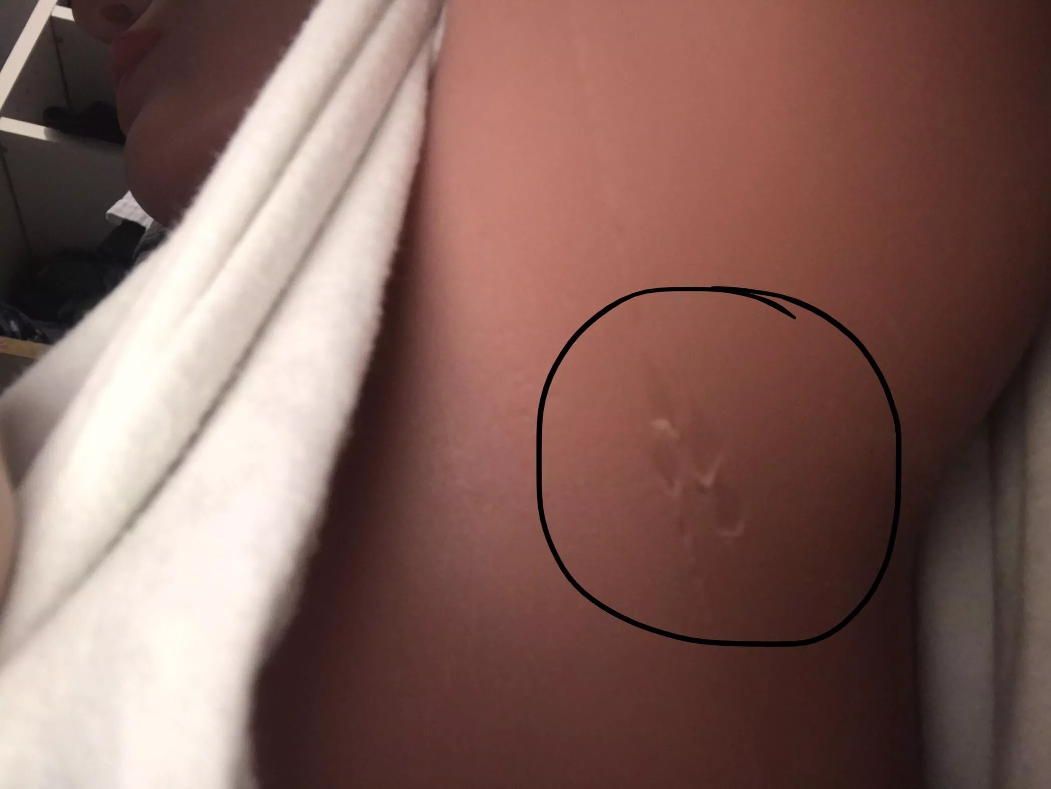 Ummm posted by TitaniumViper_7615