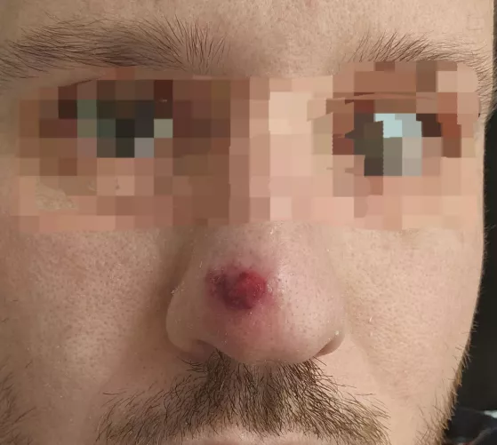 Will this be a good one? Or just plasma and disappointment? by spb311