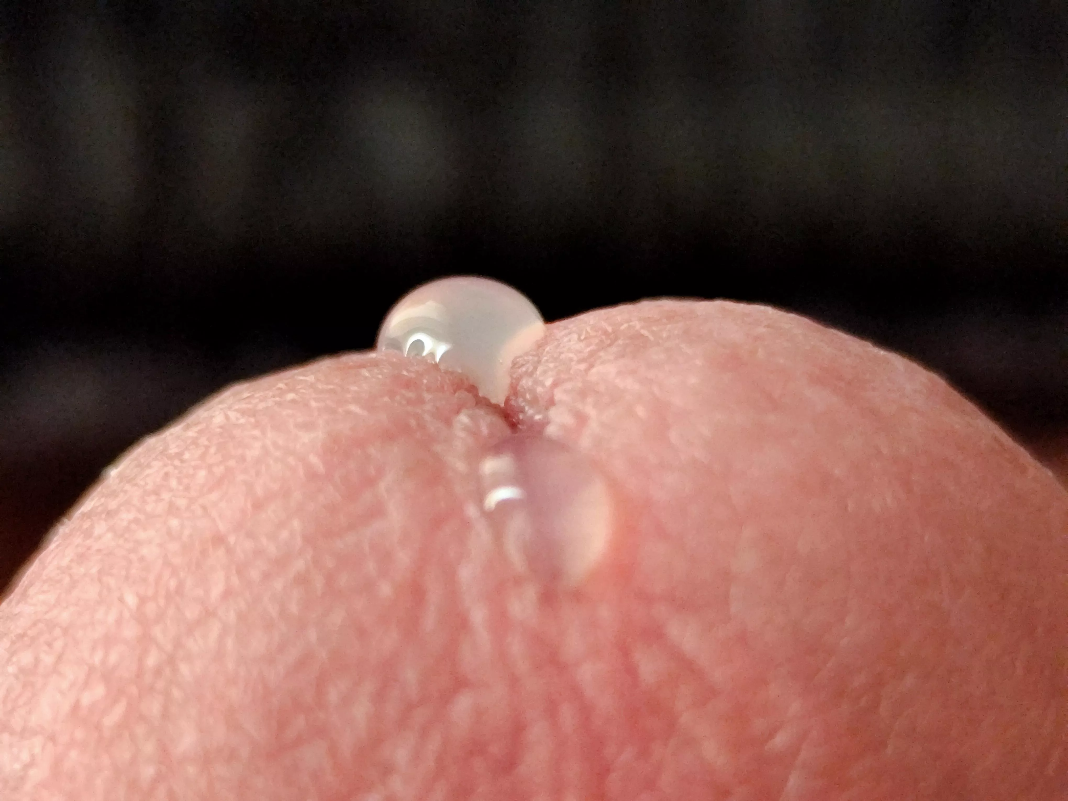 Closeup.. posted by No_Item1999