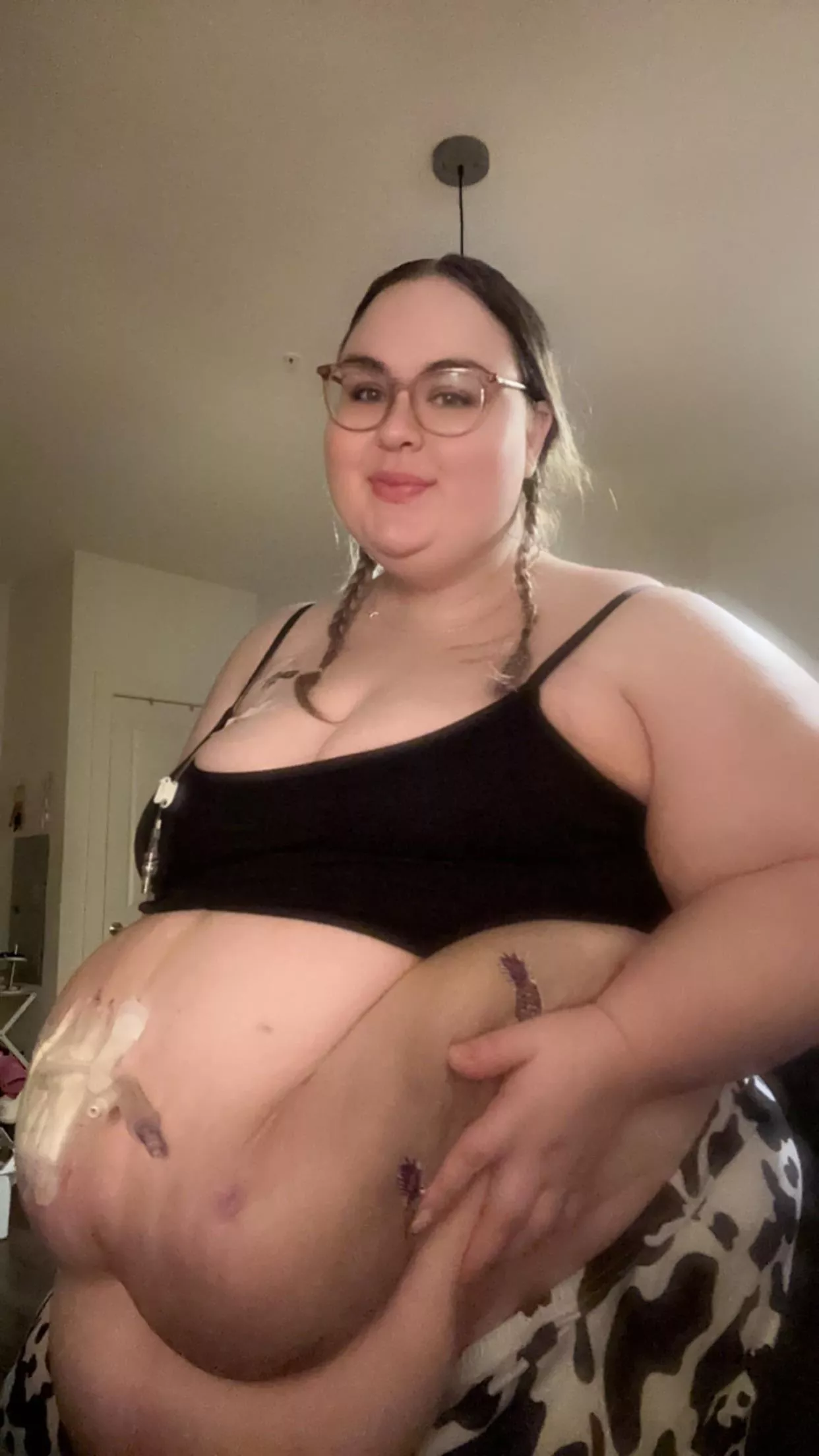 hi 🥺♥️ disabled bellies need love too  posted by Blondebaebe