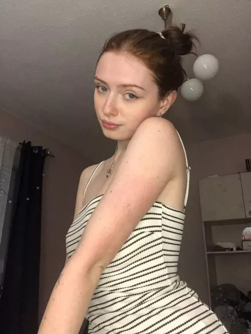 [IRTR] There will be even more freckles in summer by MeredithDixongt