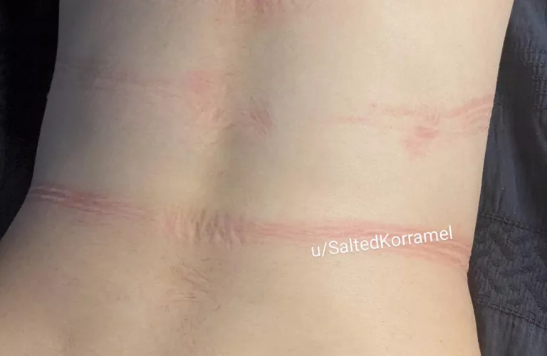 Some of the rope marks on my back 🖤  by SaltedKorramel
