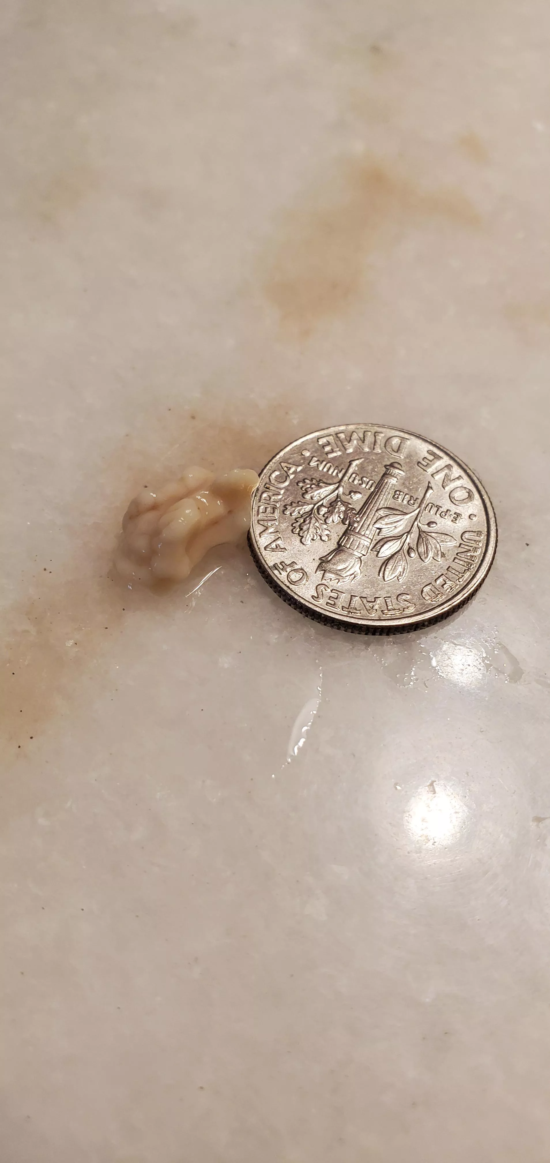 Tonsil stone I cleared this morning.  posted by myoldaccountlocked