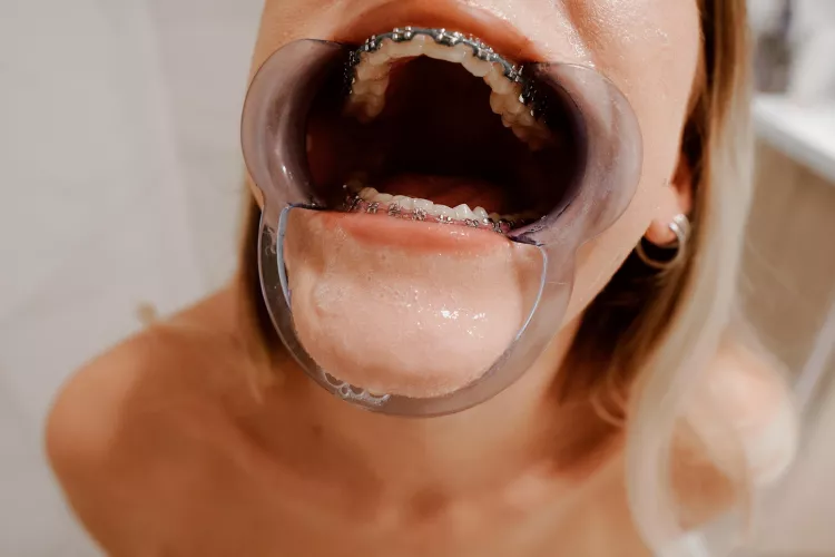 Just a big open hole by andie_x