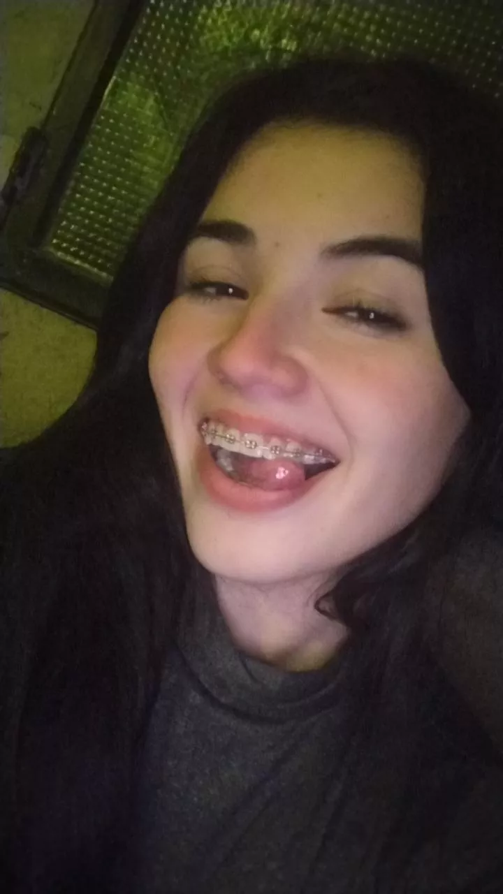 Last month without my braces. Will I get used to it? posted by barbyantonela