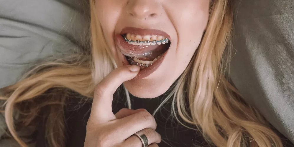 Oops, got a lil’ something stuck in my teeth. Can you get it for me? by andie_x