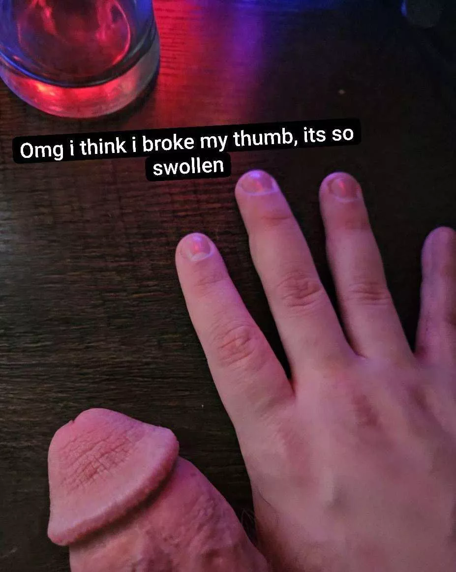 Let's wish him a quick recovery! posted by Honey__Mahogany