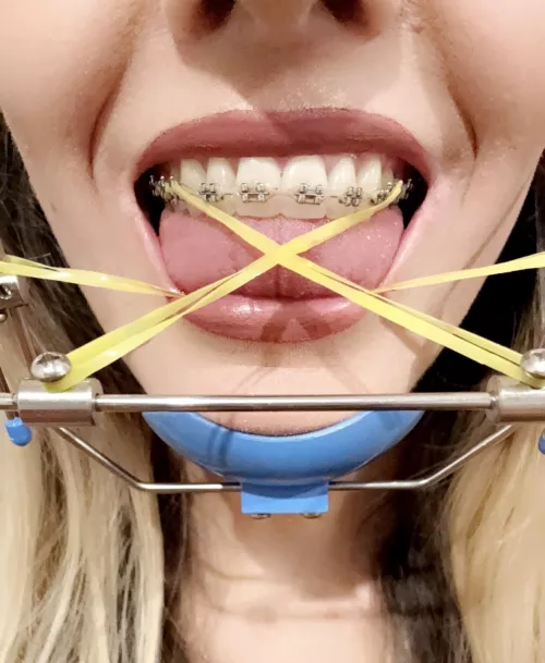 Headgear fun 👅 by andie_x