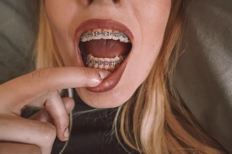 How ya like my blue and purple bands? by andie_x