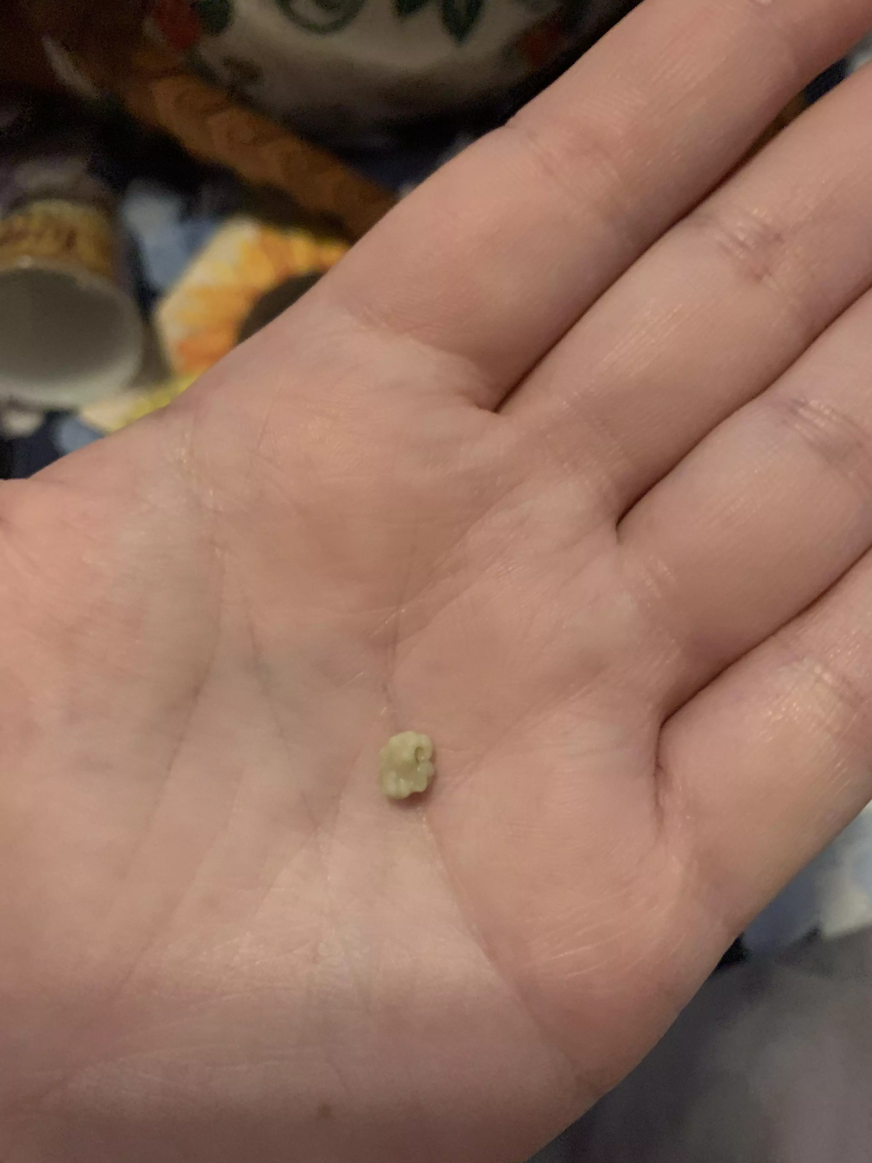 My biggest tonsil stone ever posted by suicidesluttt