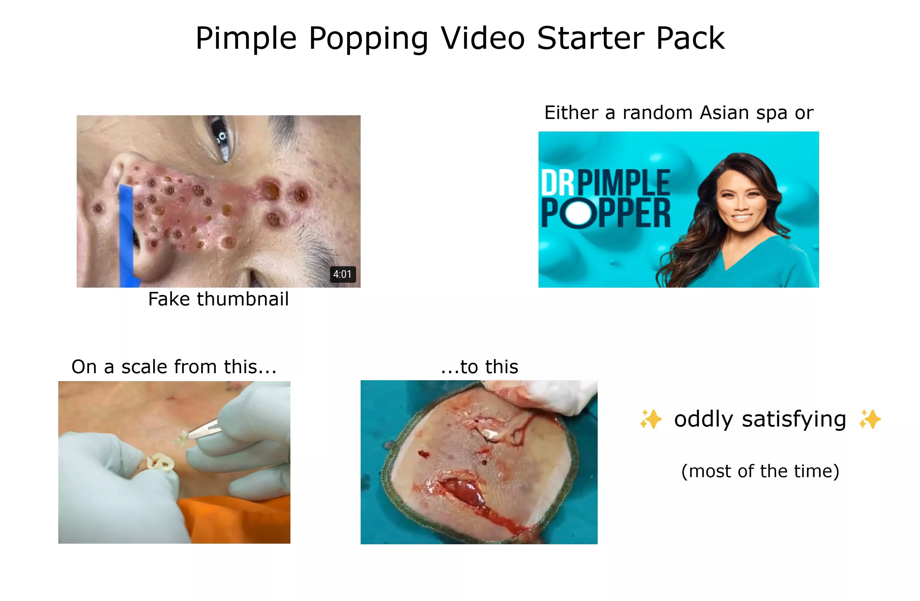 This isn't a pop, sadly, but spend enough time searching for pimple popping videos on YouTube and you notice some trends.  posted by PinkOneHasBeenChosen