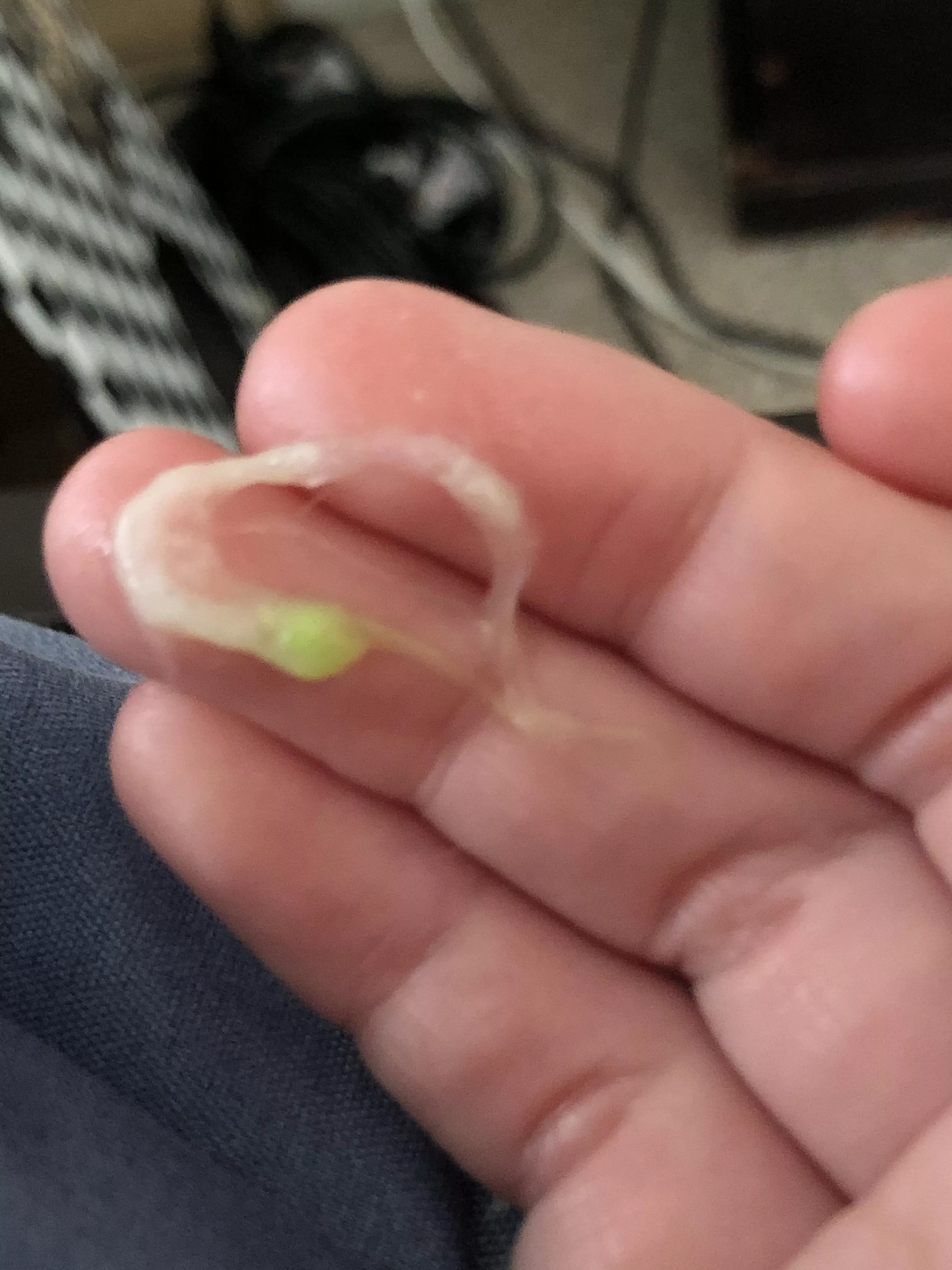 Bright green phlegm I coughed up posted by Crocotta1