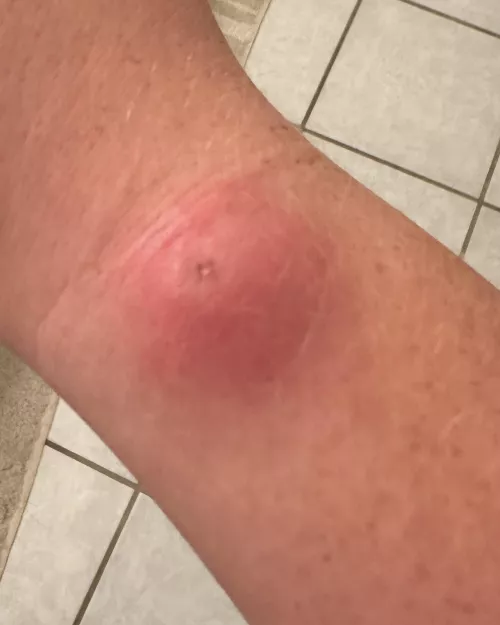 I wish this would pop so bad by ResidentAcademic