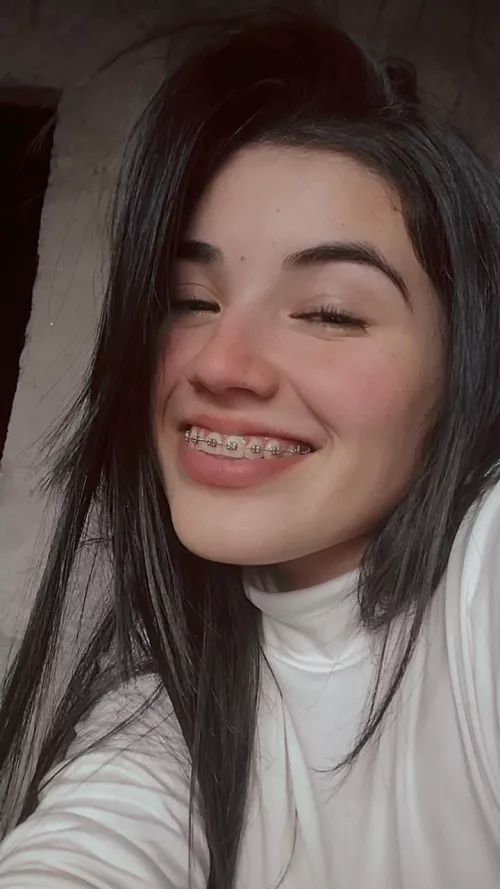 face and braces by barbyantonela