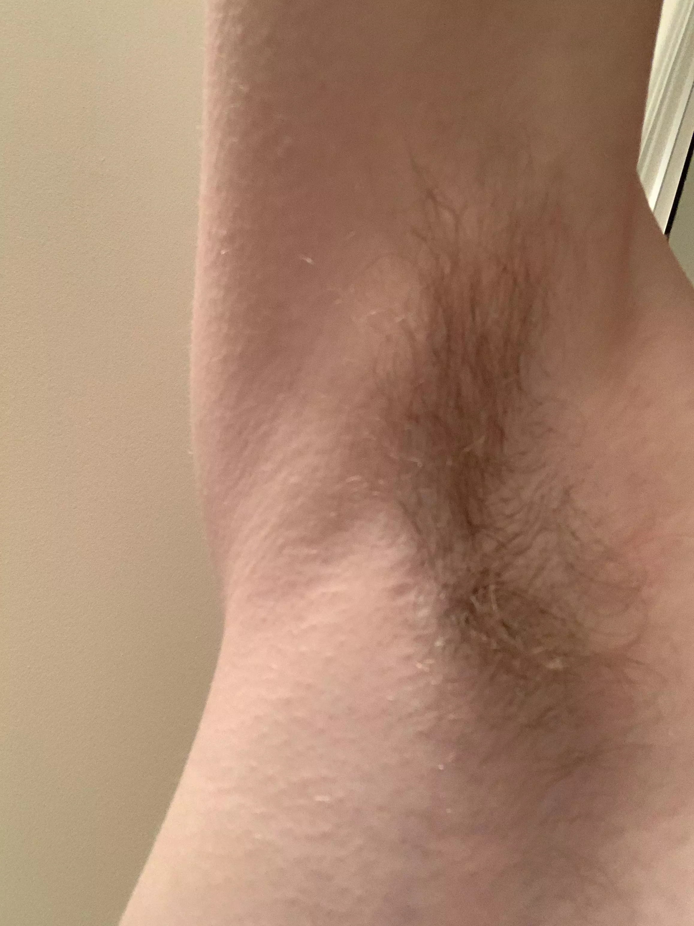 Post run pits posted by Miserable_Sir2755