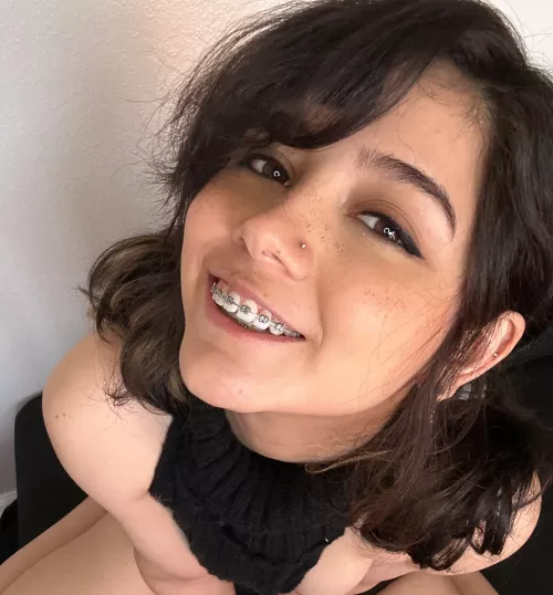 would ya finish my braces? by PupFiggy